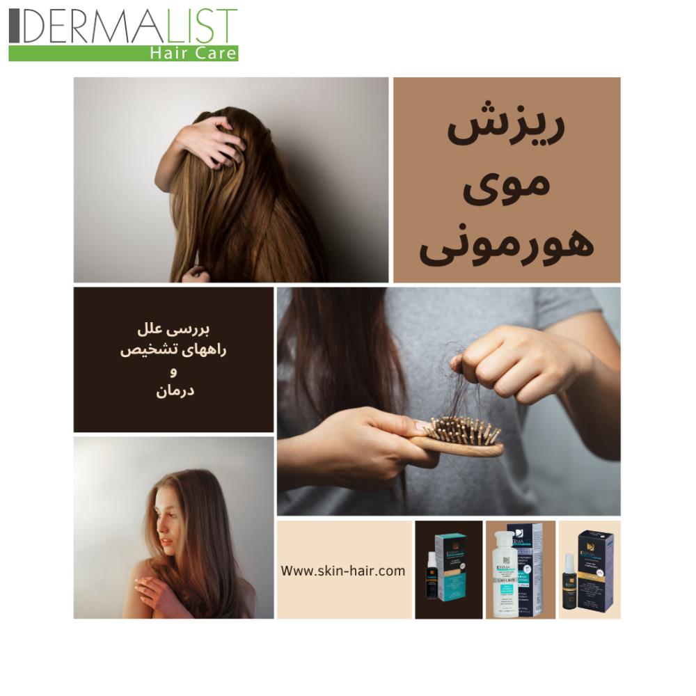 ریزش موی هورمونی: علل، درمان و معرفی محصولات مؤثر
