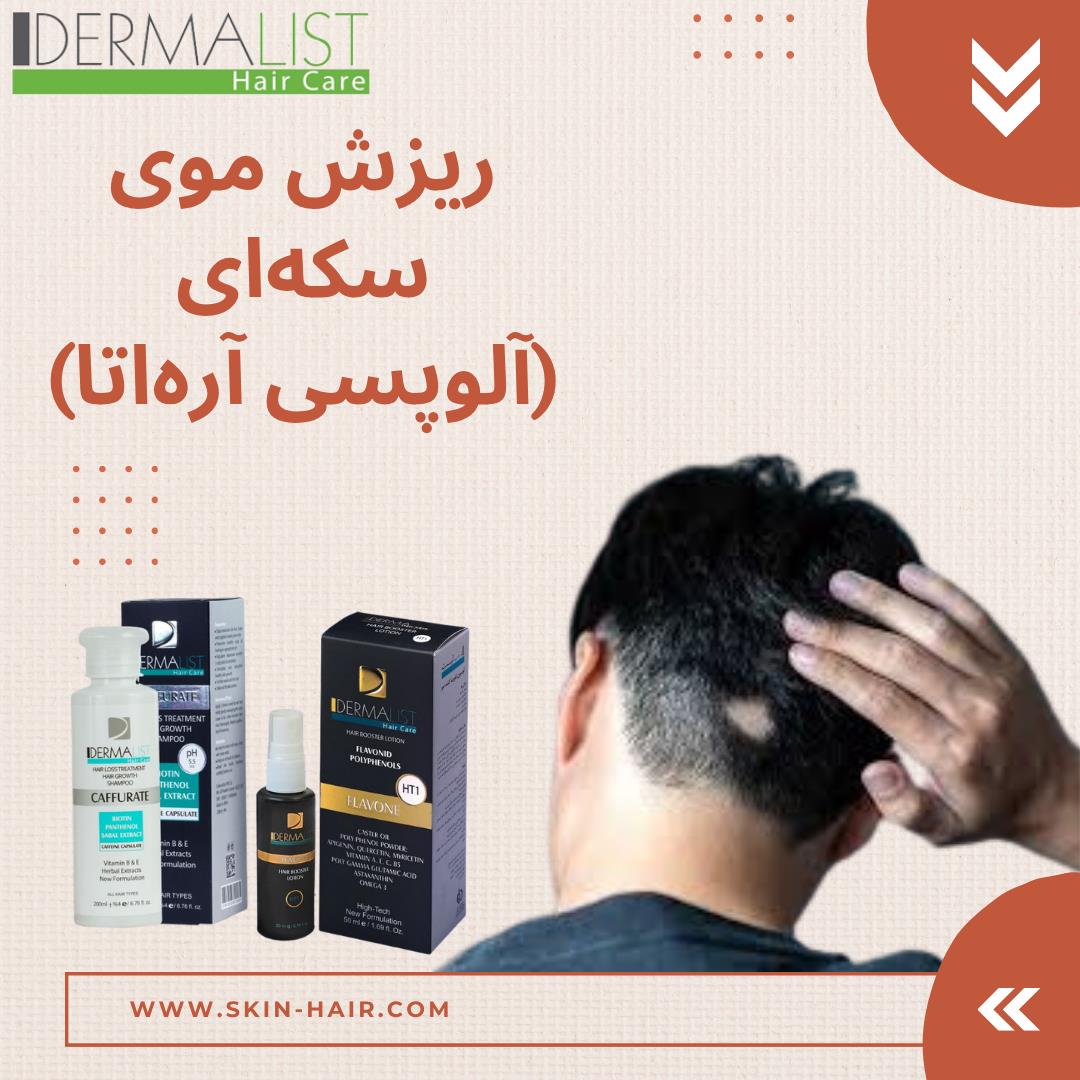 ریزش موی سکه‌ای (آلوپسی آره‌اتا): علل، علائم و راهکارهای درمانی